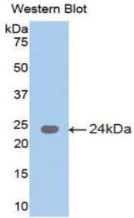 MGAM / Maltase-Glucoamylase Antibody (aa213-392)