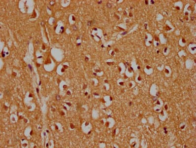 Polyclonal Rabbit anti-Human MAPK14 / p38 Antibody (IHC, IF)