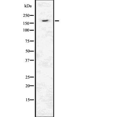 INSRR Antibody