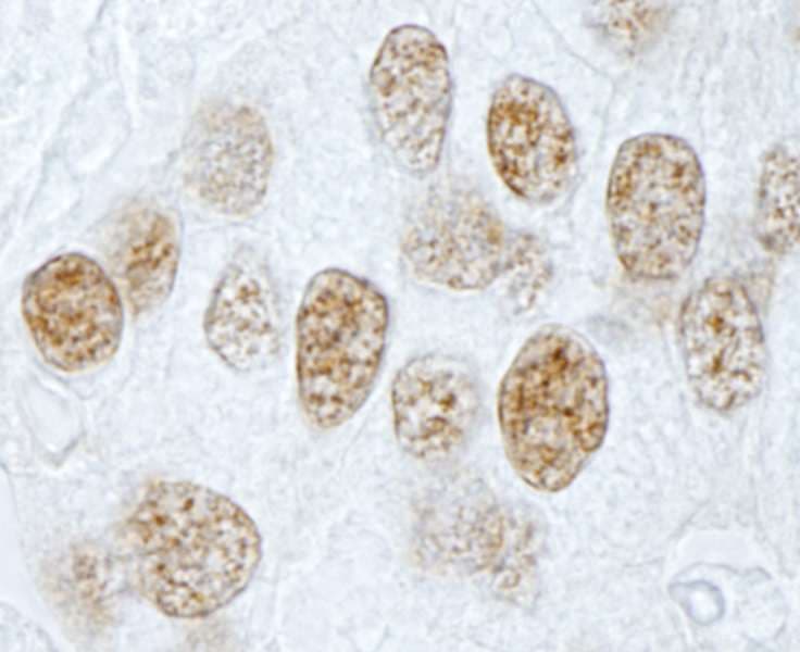Polyclonal Rabbit anti-Human PLRG1 Antibody (aa464-514, IHC, IF)