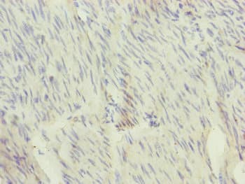 Polyclonal Rabbit anti-Human SFI1 Antibody (IHC, WB)