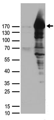 PALB2 Antibody