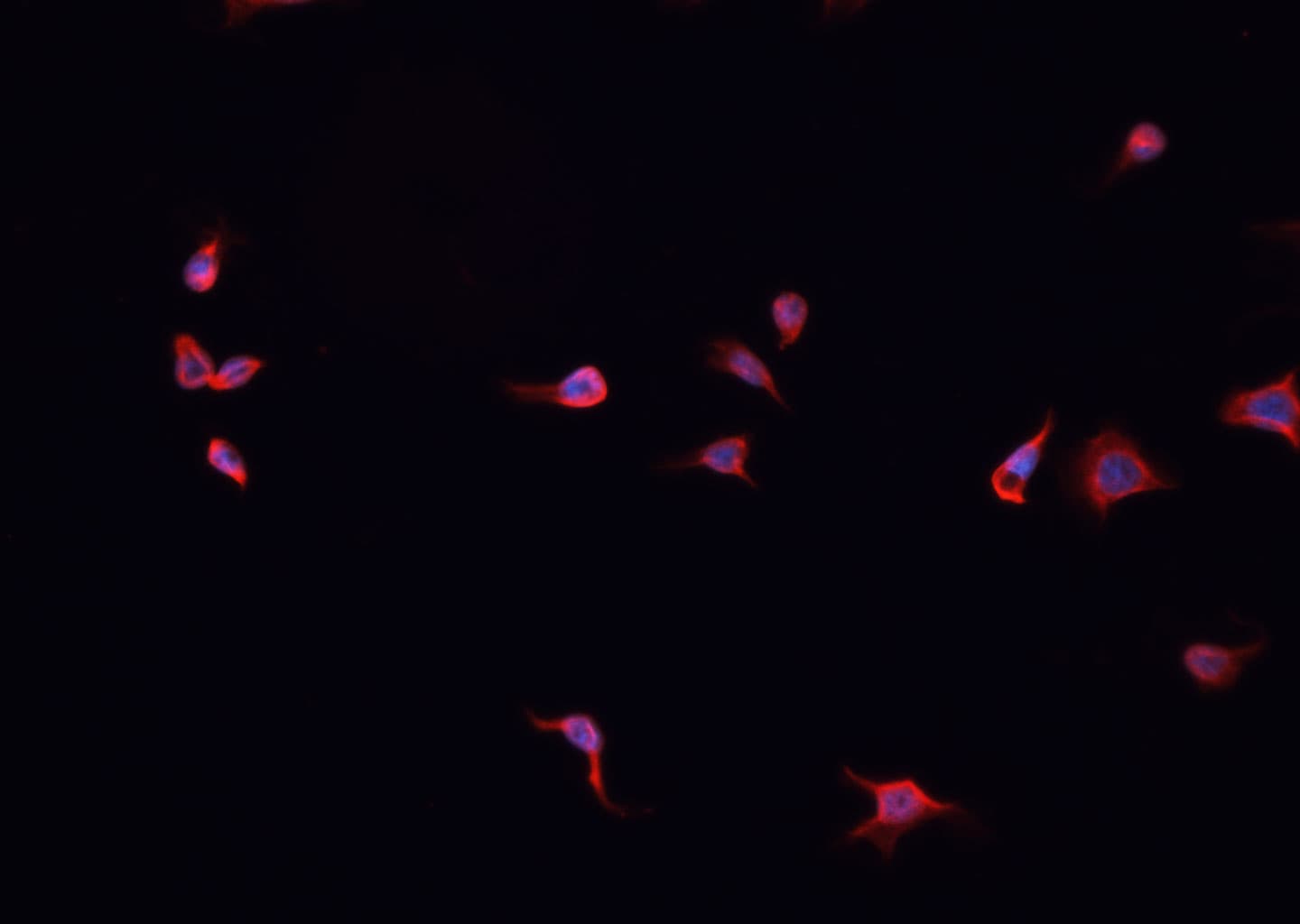 Polyclonal Rabbit anti-Human RELA / NFKB p65 Antibody (IHC, IF, WB)