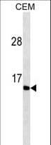 Gastrin Antibody (aa49-78)