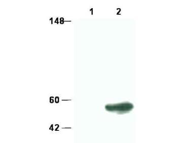 Polyclonal Rabbit anti-Human SMAD3 Antibody (WB)