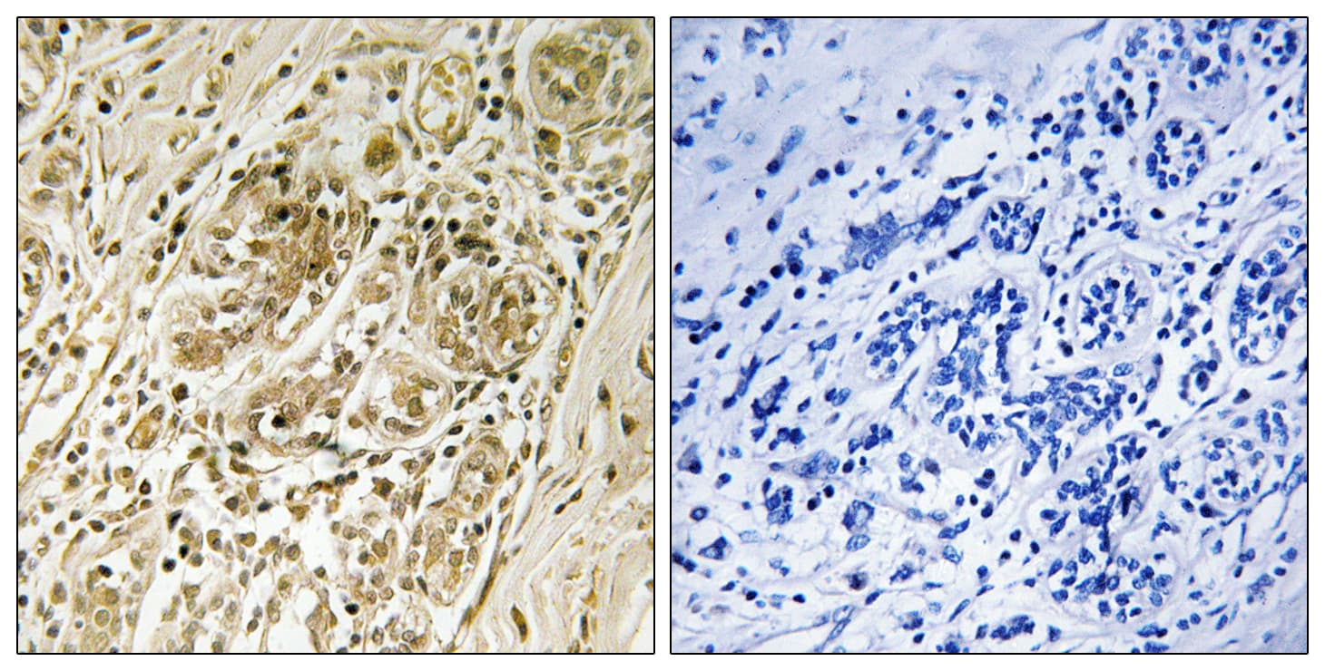 IRS1 Antibody (phospho-Ser639)