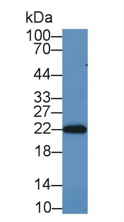PRDX2 / Peroxiredoxin 2 Antibody (aa6-164)