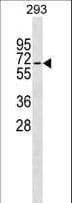 Polyclonal Rabbit anti-Human ZWILCH Antibody (aa482-508, WB)