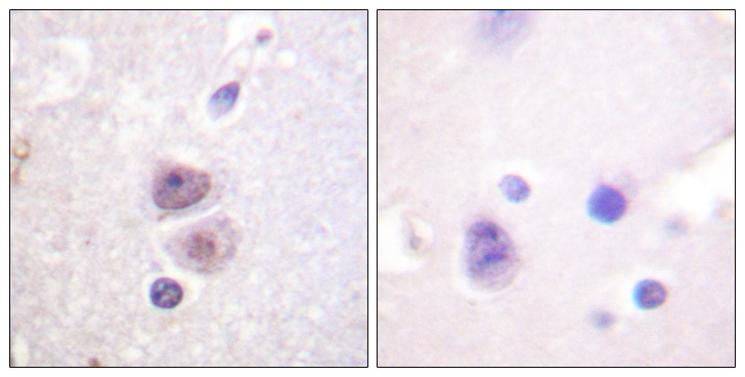 MAPK14 / p38 Antibody (p322)
