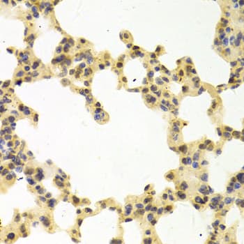 Polyclonal Rabbit anti-Human RANGAP1 Antibody (IHC, IF, WB)