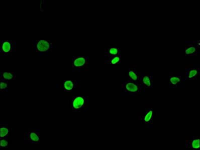 Polyclonal Rabbit anti-Human HIST1H3A Antibody (IHC, IF, WB)