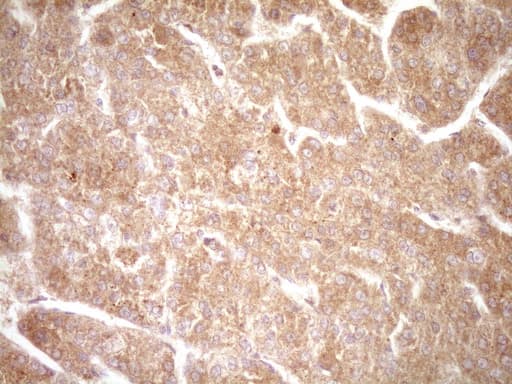 ERBB3 / HER3 Antibody (clone OTI3E10)
