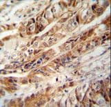 LEREPO4 / ZC3H15 Antibody (aa367-395)