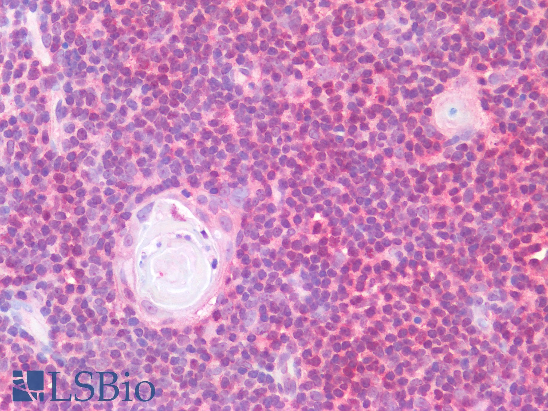 IHC-plus™ FOXC1 Antibody