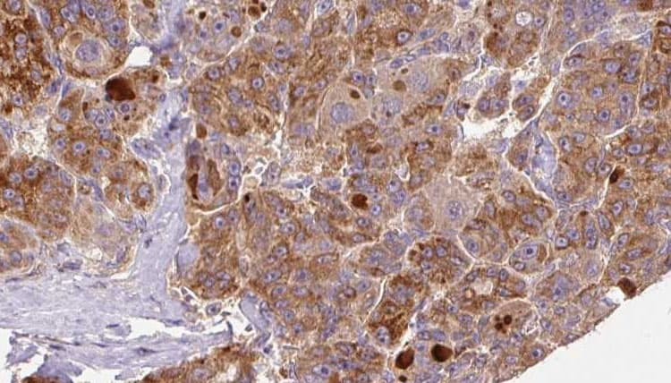 GnRH-II-R / GNRHR2 Antibody