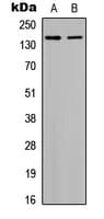 HDAC6 Antibody (N-Terminus)
