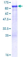 Human ASMTL Protein (Recombinant GST)