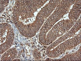 MAP2K1 / MKK1 / MEK1 Antibody (clone OTI7E2)