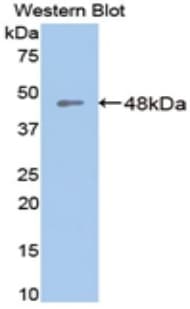 Aspartate Aminotransferase Antibody (aa1-413)