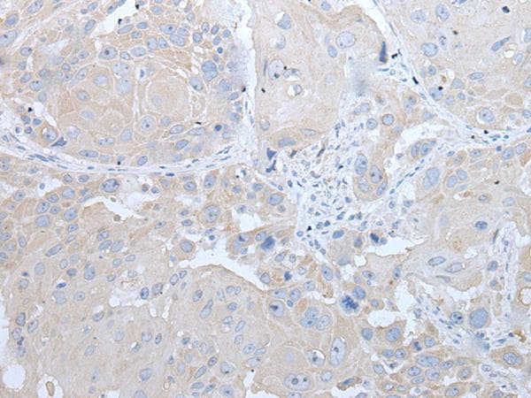 IFN Beta / Interferon Beta Antibody