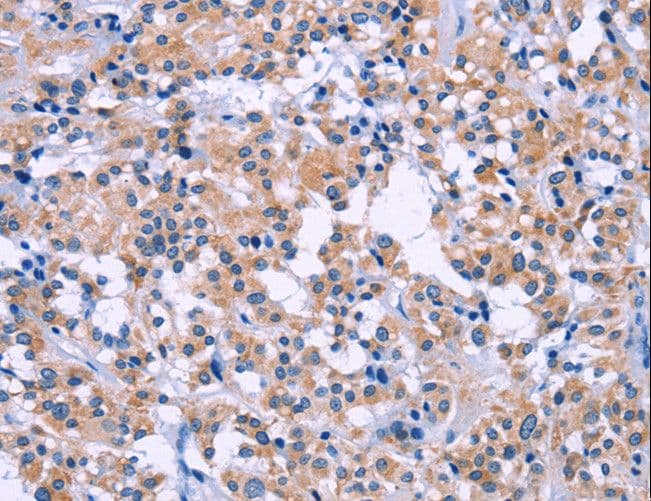 DUSP22 / JSP 1 Antibody