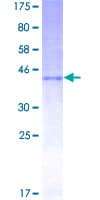 Human IFN Beta / Interferon Beta Protein (Recombinant GST)