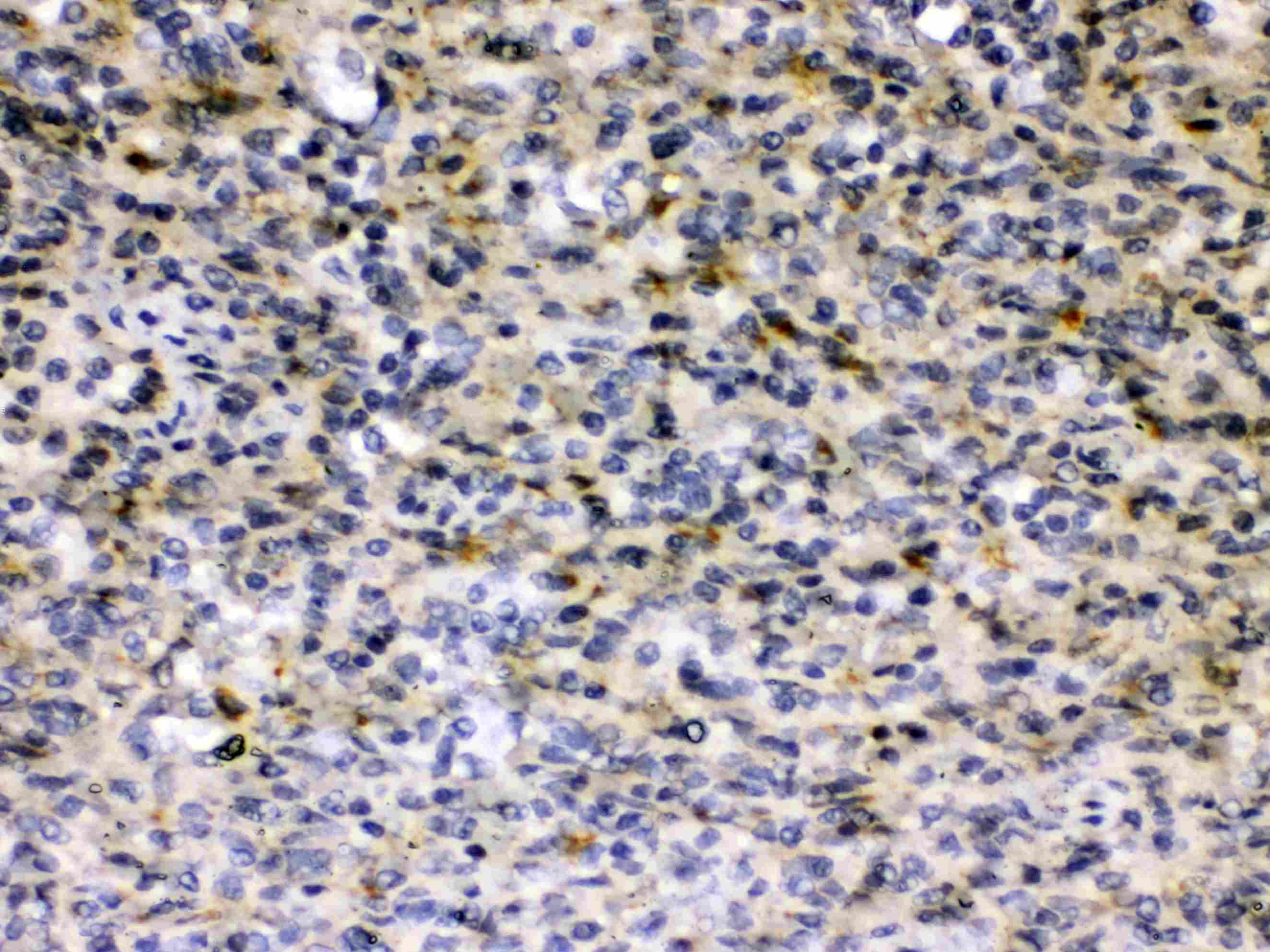 HBV / Hepatitis B Virus Antibody