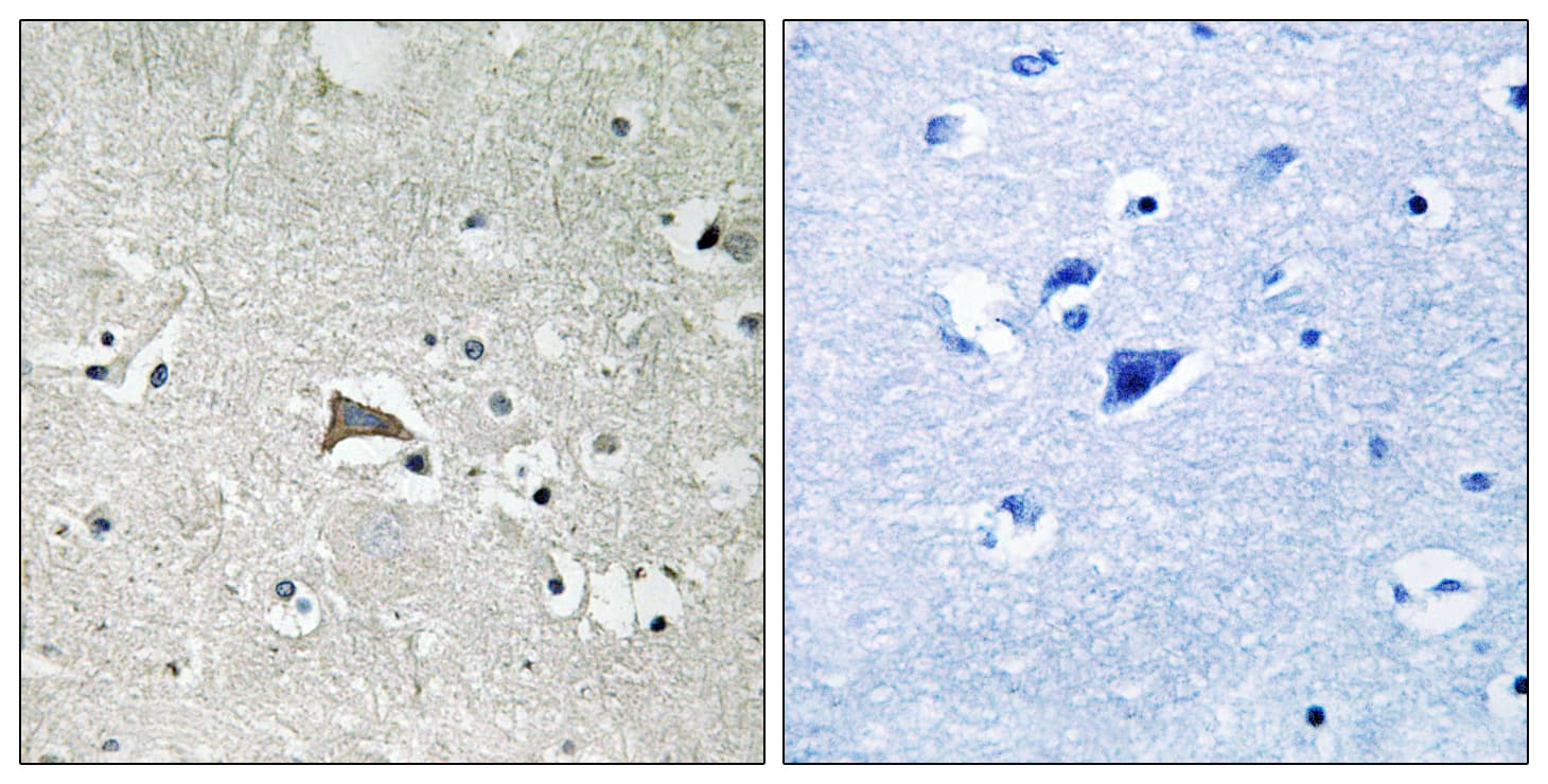 FLT1 / VEGFR1 Antibody (aa1016-1065)