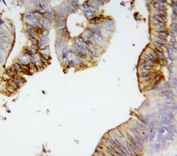 Polyclonal Rabbit anti-Human ANXA2 / Annexin A2 Antibody (aa179-199, IHC, WB)