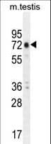 ANKEF1 / ANKRD5 Antibody (aa721-749)