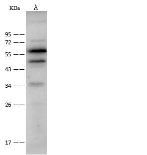 Polyclonal Rabbit anti-Human CAP1 Antibody (IF, WB)