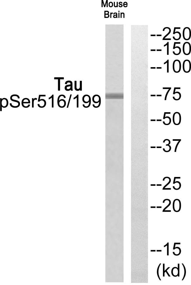 MAPT / Tau Antibody (phospho-Ser516/199)