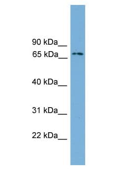 Polyclonal Rabbit anti-Mouse Ifi204 Antibody (aa101-150, WB)