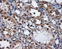PSMC3 Antibody (clone OTI8D6)