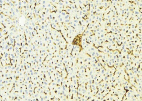 Polyclonal Rabbit anti-Human CYP4V2 Antibody (aa339-364, IHC, IF, WB)