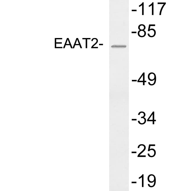 SLC1A2 / EAAT2 / GLT-1 Antibody (aa117-166)