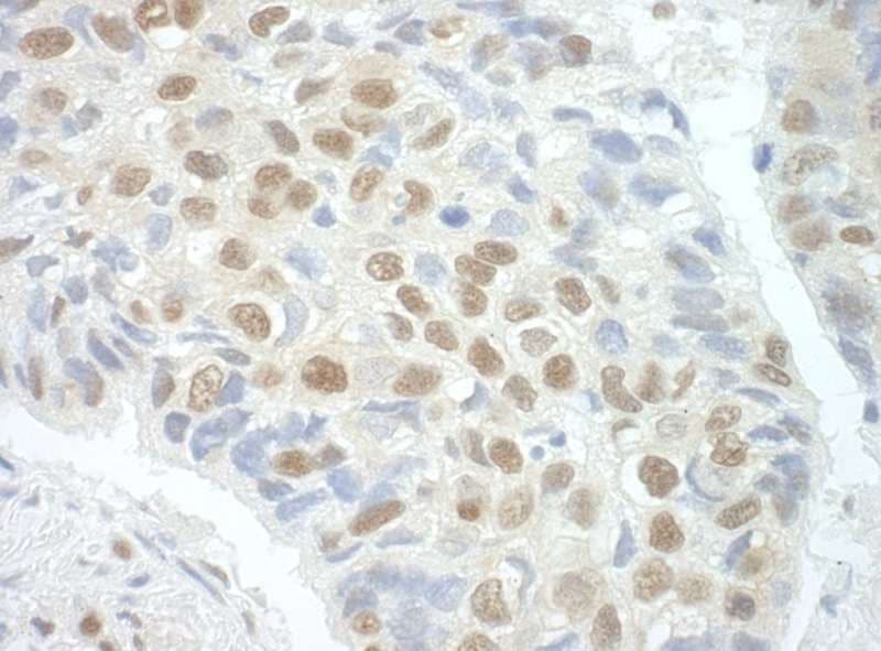 POGZ Antibody (aa1360-1410)