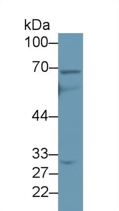 ABCD4 Antibody (HRP)