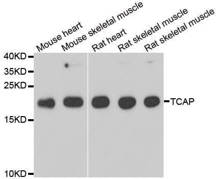 Polyclonal Rabbit anti-Human TCAP / Telethonin Antibody (IHC, IF, WB)