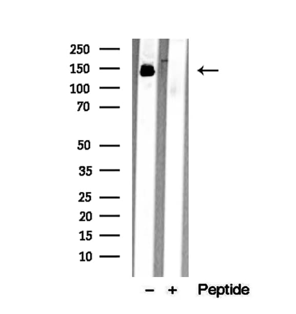 DIAPH1 Antibody
