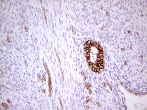 ABCB1 / MDR1 / P Glycoprotein Antibody (aa995-1280, clone OTI1A7, Carrier-free)