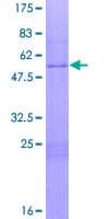 Human HOXA6 Protein (Recombinant GST)