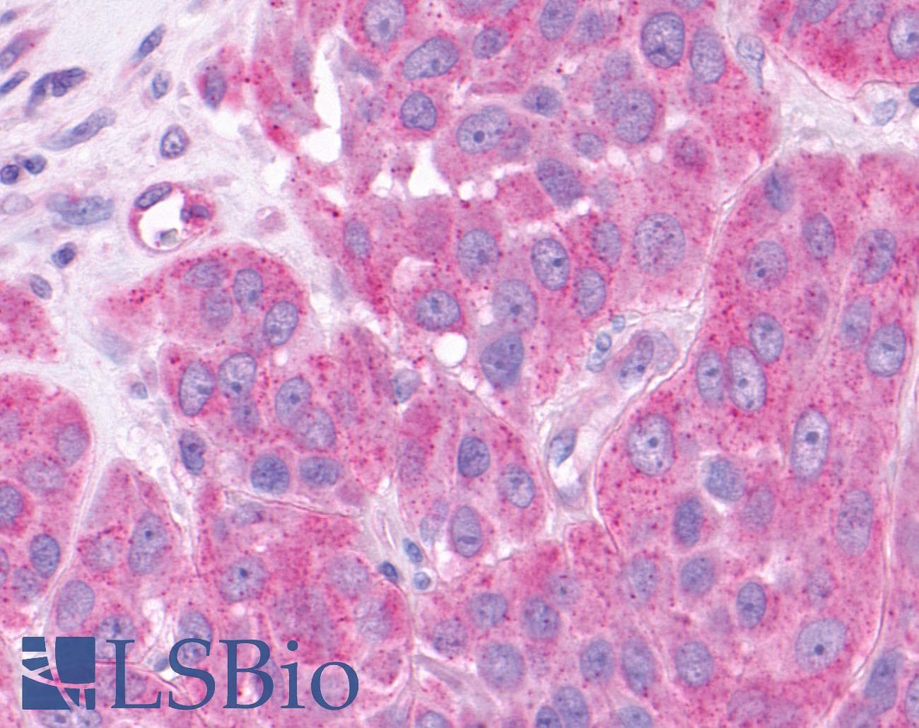 IHC-plus™ NPFF2 / NPFFR2 Antibody (Extracellular Domain)