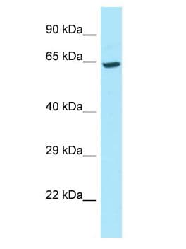 MCCC1 Antibody (aa204-253)