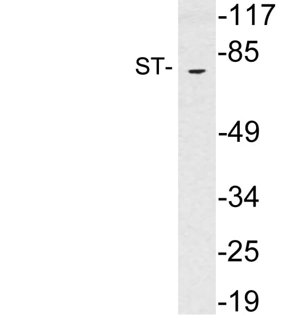 SLC6A4 / SERT Antibody (aa348-397)