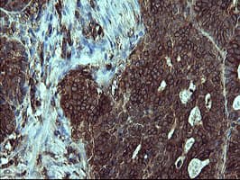 IHC-plus™ CD45 / LCA Antibody (clone 4C11)