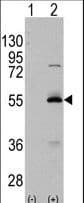 IHC-plus™ ALDH6A1 Antibody (aa367-396)
