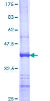 Human UGT1A9 Protein (Recombinant GST, N-terminus)