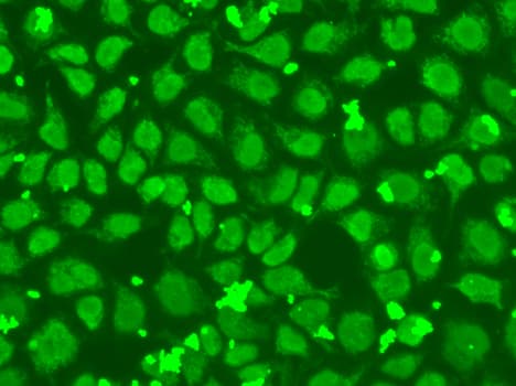 FEN1 Antibody