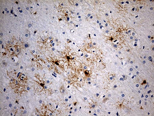 GPR17 Antibody (C-Terminus, clone OTI10B8)